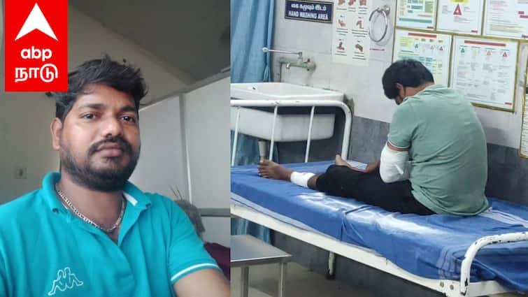 கதறி அழுத மனைவி.. கை, கால் காயத்துடன் கைது செய்யப்பட்ட ரவுடி.. பின்னணி என்ன ?